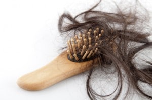 microneedling for Hair loss
