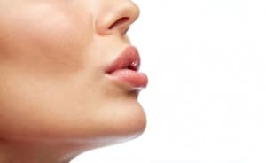 volbella for lip augmentation
