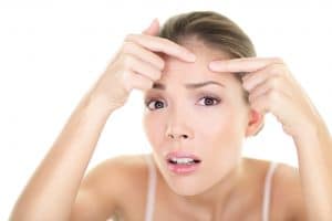 stockfresh 3397745 acne spot pimple spot skin care girl skin problem sizeS