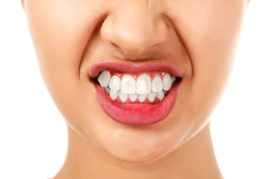 Young woman showing teeth and making an "ish" face