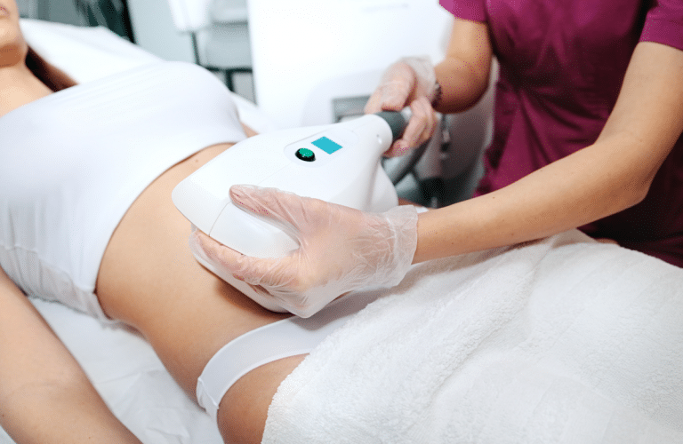 Woman having Coolsculpting on her stomach