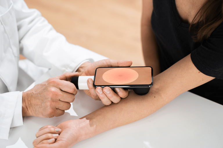 Doctor showing close up picture on his phone using New Dermatology App