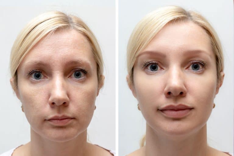 Before and after pictures of a young blonde woman