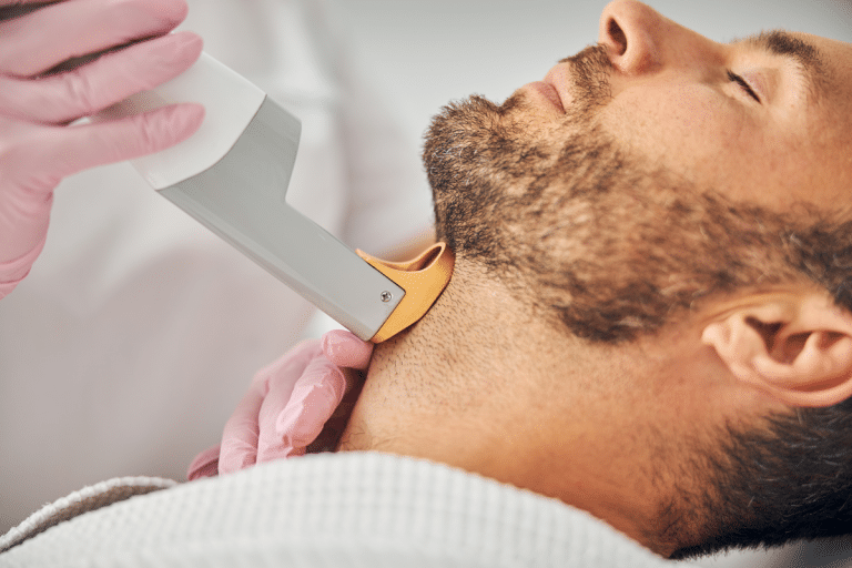 Laser Hair Removal Services on a man's neck under his chin
